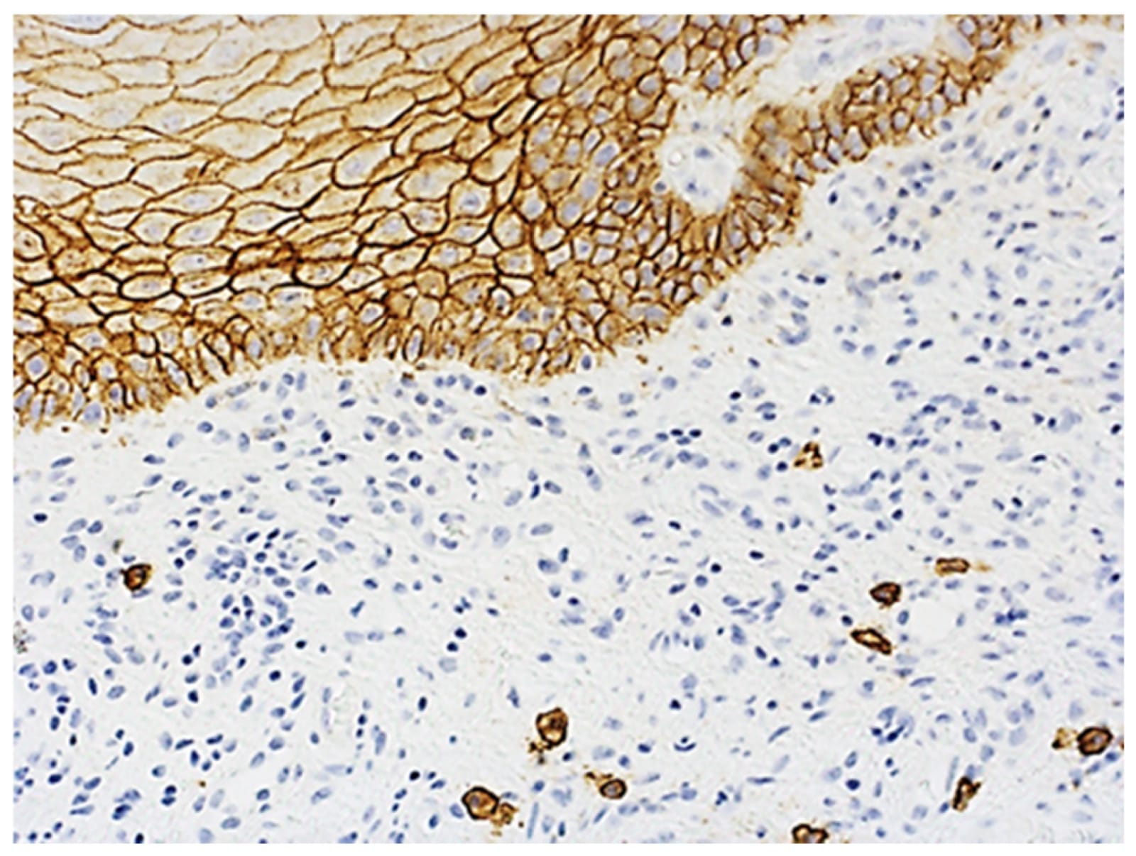 Immunohistochemistry